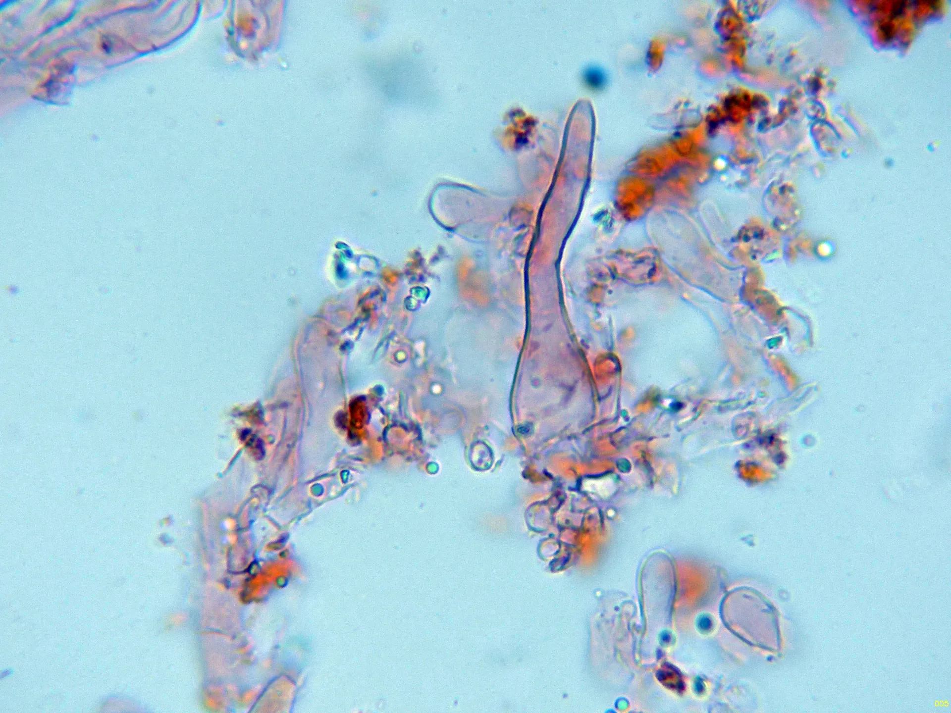 Microscopía de Peniophorella praetermissa - 10 - Cistidio-005